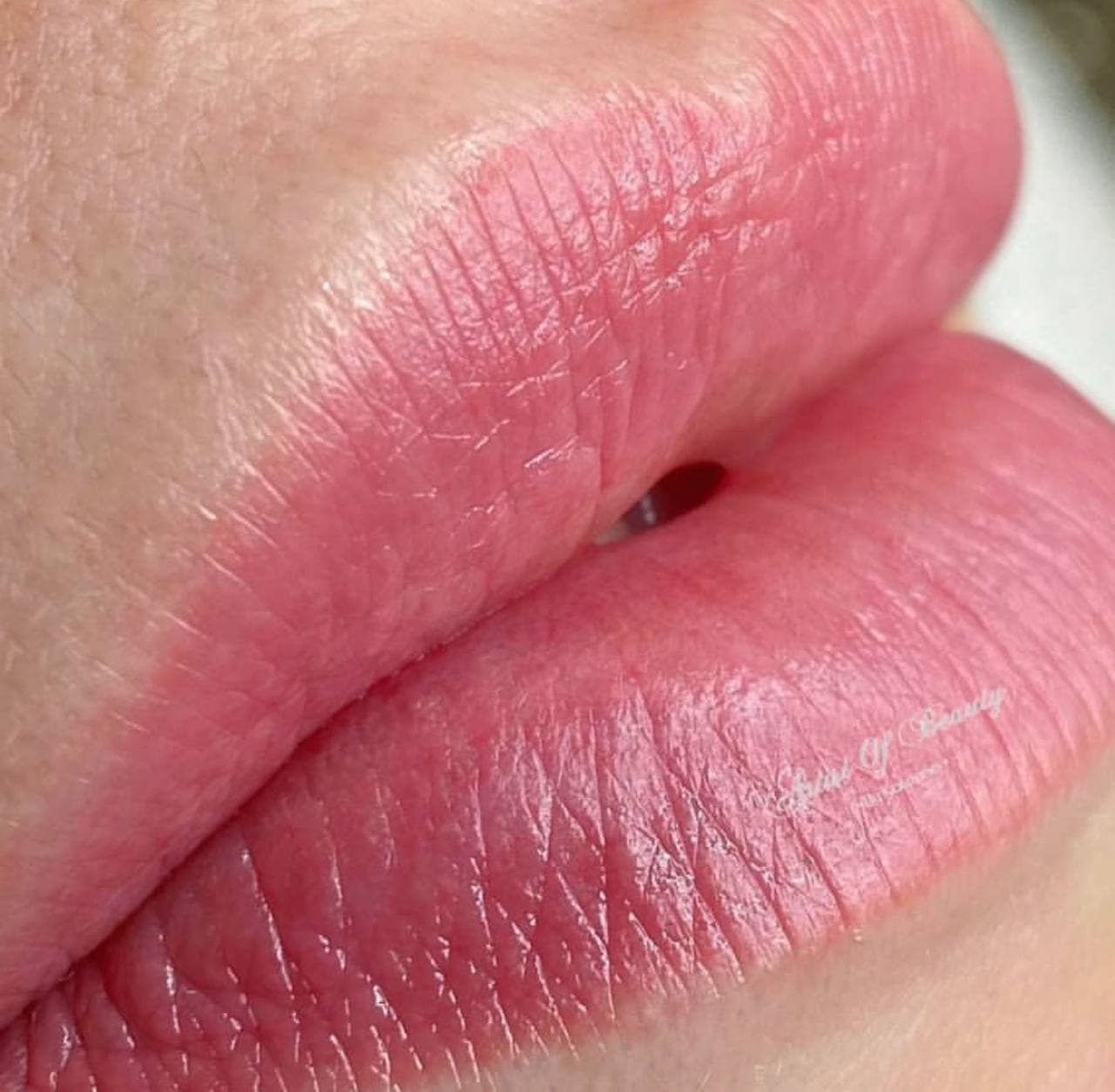 Lip blush result
