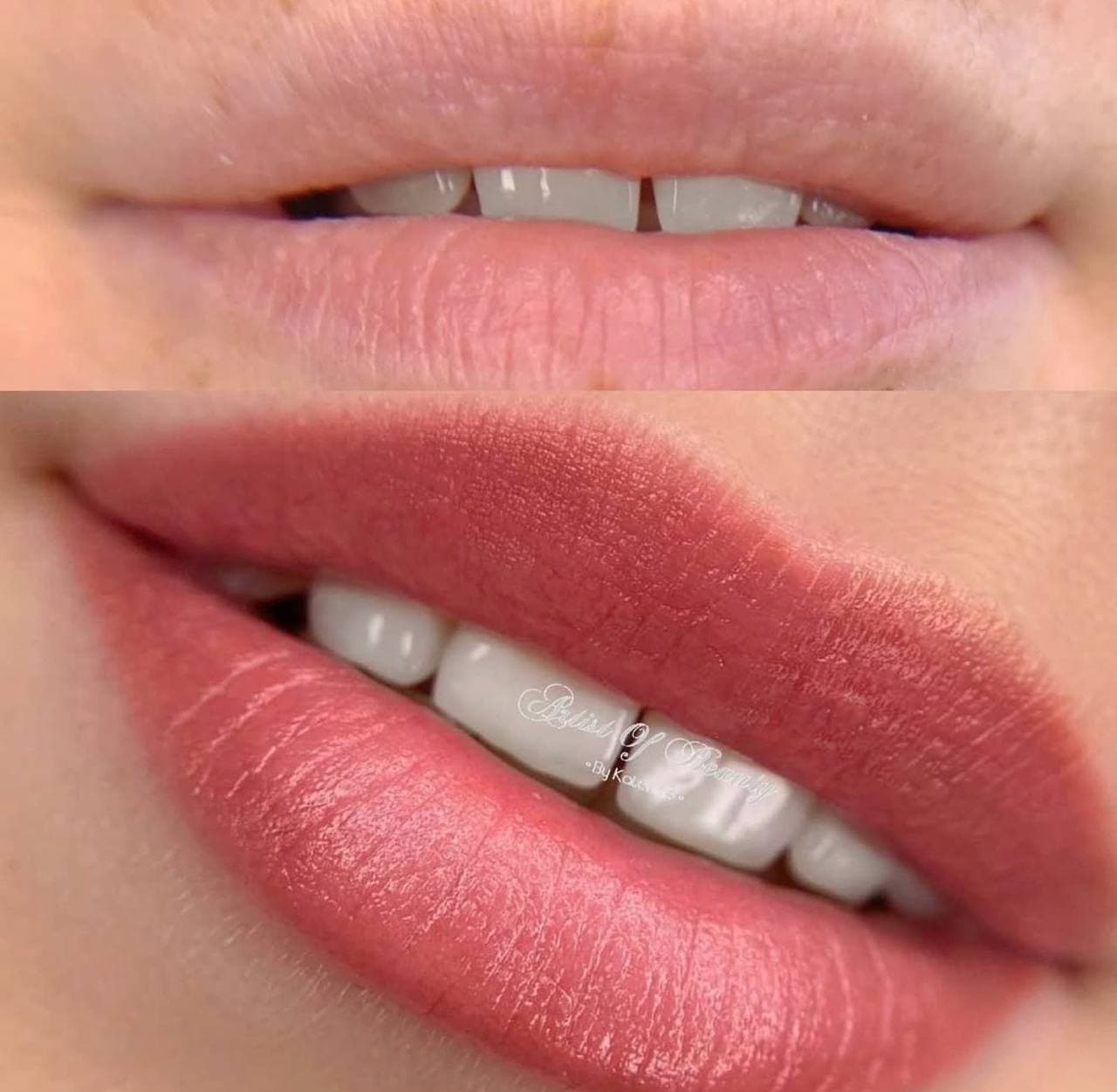 Lip blush result