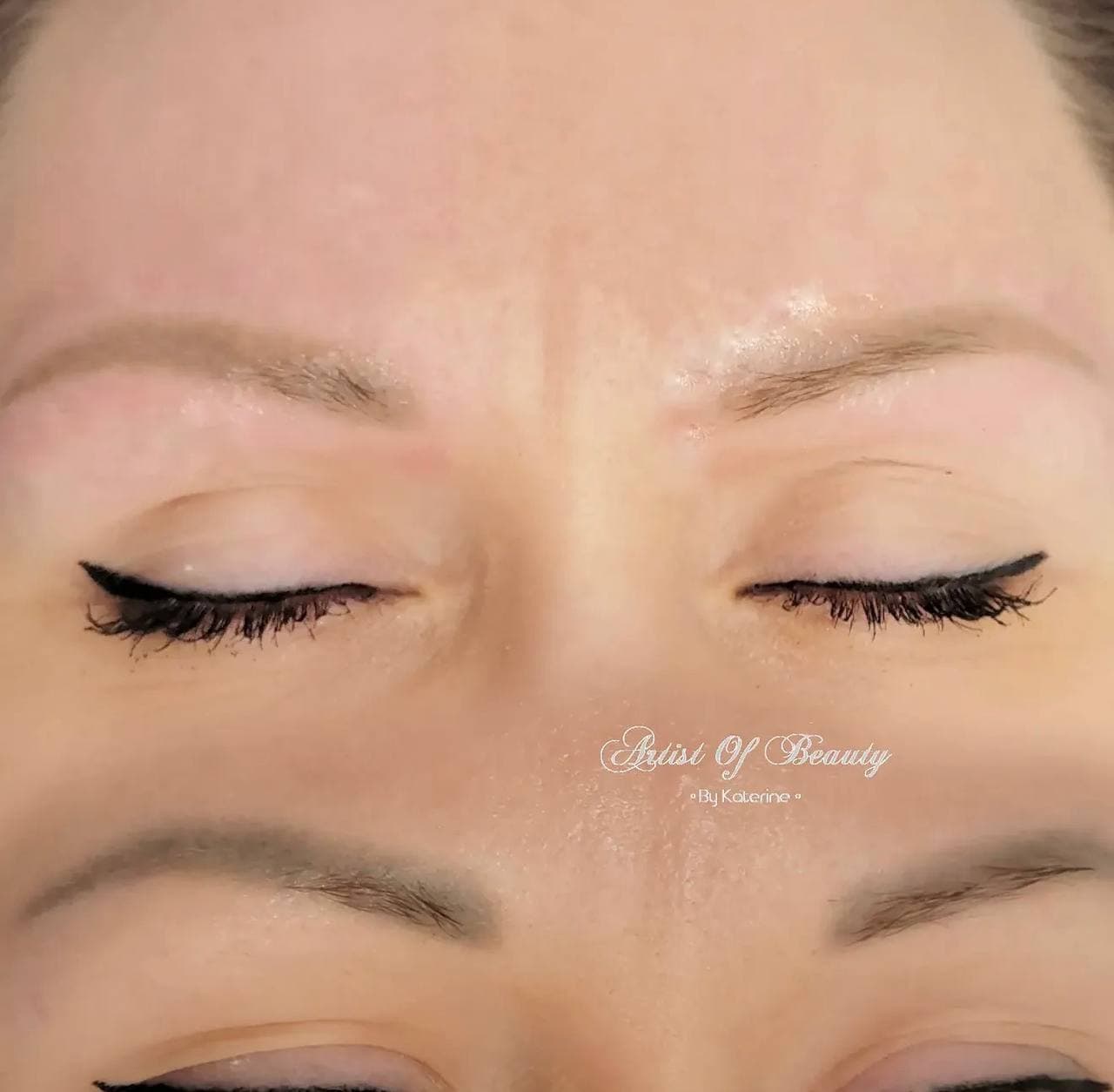 Brow correction result