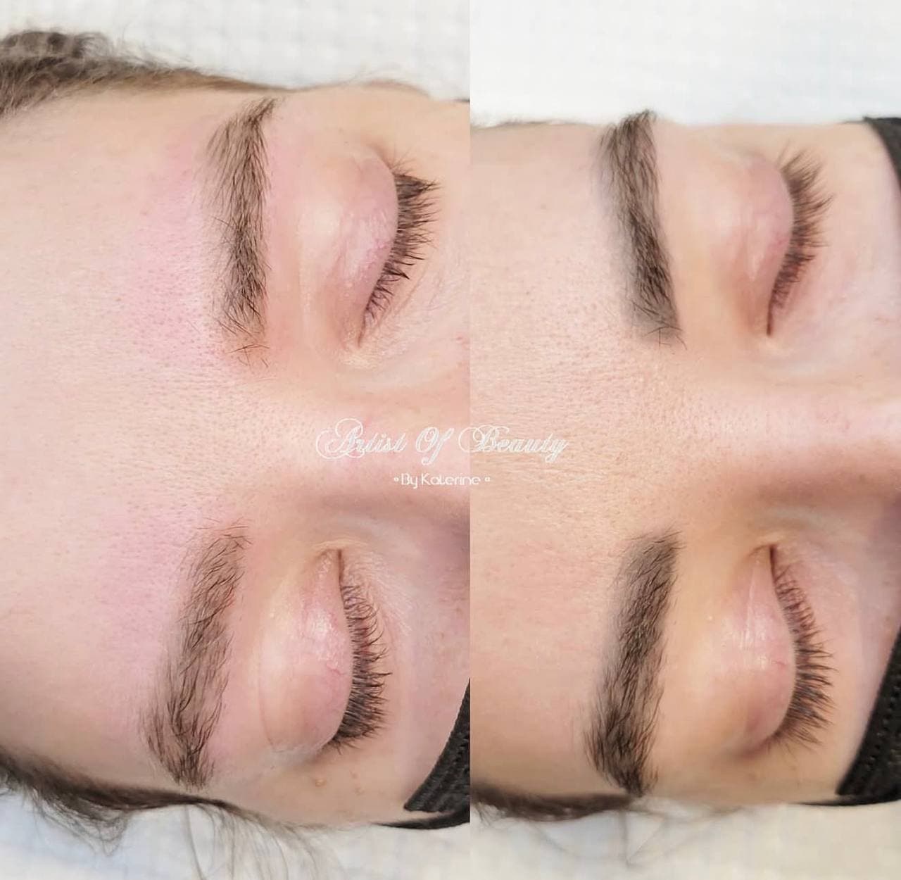 Brow correction result