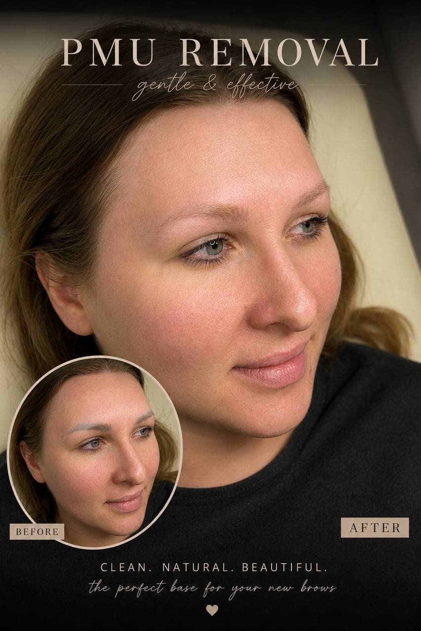 Brow correction result